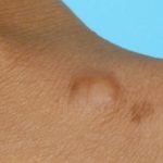 granular-cell1__protectwyjqcm90zwn0il0_focusfillwzi5ncwymjisingildfd-8137063-7601496-jpg-1614616