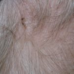 head-lice-19__protectwyjqcm90zwn0il0_focusfillwzi5ncwymjisingildfd-1537627-9552916-jpg-5931232
