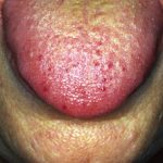 hht1__protectwyjqcm90zwn0il0_focusfillwzi5ncwymjisingilde2xq-7786633-5485814-jpg-7938206