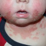 icd2__protectwyjqcm90zwn0il0_focusfillwzi5ncwymjisingildfd-1657694-4033295-jpg-5659331