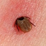 ixodes__protectwyjqcm90zwn0il0_focusfillwzi5ncwymjisingildfd-6865276-9644889-jpg-6805363