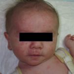 job-syndrome-2__protectwyjqcm90zwn0il0_focusfillwzi5ncwymjisingildfd-3842367-2209736-jpg-2623455