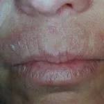 Lippen-ppd__protectwyjqcm90zwn0il0_focusfillwzi5ncwymjisingildfd-8059863-7532299-jpg-9112816
