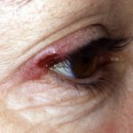 lymph-pap1__protectwyjqcm90zwn0il0_focusfillwzi5ncwymjisinkildg1xq-3997565-2951599-jpg-4749111