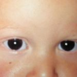 madarosis-07__protectwyjqcm90zwn0il0_focusfillwzi5ncwymjisingildfd-7946261-4885695-jpg-7792524