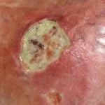 martorell1__protectwyjqcm90zwn0il0_focusfillwzi5ncwymjisinkildm2xq-5515707-5313714-jpg-5850884