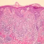 nktcell-fig-1__protectwyjqcm90zwn0il0_focusfillwzi5ncwymjisingildfd-6982241-5106593-jpg-7959083