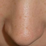 open-pores__protectwyjqcm90zwn0il0_focusfillwzi5ncwymjisingildfd-3695656-4049081-jpg-1343022