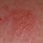 patch-test-positive__protectwyjqcm90zwn0il0_focusfillwzi5ncwymjisingildfd-2889731-9396050-jpg-9367417