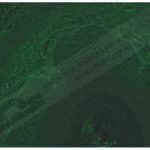 pemphigus-vulgaris-iif__protectwyjqcm90zwn0il0_focusfillwzi5ncwymjisinkildbd-9364598-1160706-jpg-2474103