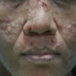 penicilliosis-v3__protectwyjqcm90zwn0il0_focusfillwzi5ncwymjisingildfd-9641645-4742551-jpg-2616965