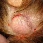pilar-cyst-2__protectwyjqcm90zwn0il0_focusfillwzi5ncwymjisingildbd-1752090-8135937-jpg-3414213