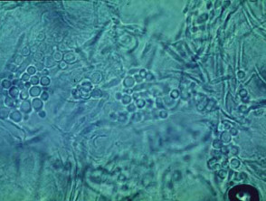 Microscopía de Malassezia