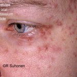 pot-iodide__protectwyjqcm90zwn0il0_focusfillwzi5ncwymjisingildhd-7638815-1068983-jpg-7663569