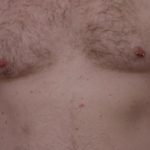 psoriasi-pasi-021__protectwyjqcm90zwn0il0_focusfillwzi5ncwymjisinkildewmv0-8316008-5168096-jpg-9252466