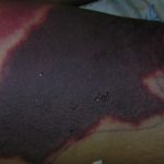 purpura7__protectwyjqcm90zwn0il0_focusfillwzi5ncwymjisingildfd-4586006-5671538-jpg-3631024