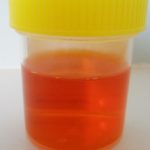 rifampicin-urine__protectwyjqcm90zwn0il0_focusfillwzi5ncwymjisinkildg1xq-2919994-1538422-jpg-1326155