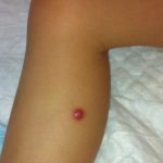 rosai-dorfman2__protectwyjqcm90zwn0il0_focusfillwzi5ncwymjisinkildg1xq-8232104-8512682-jpg-9359956