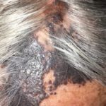 satellitosis-melanoma-25__protectwyjqcm90zwn0il0_focusfillwzi5ncwymjisinkildg1xq-8614948-2215516-jpg-7154200