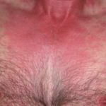 scombroid1__protectwyjqcm90zwn0il0_focusfillwzi5ncwymjisingildfd-6614953-1393271-jpg-8654851