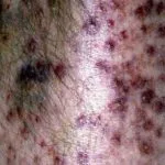 scpap__protectwyjqcm90zwn0il0_focusfillwzi5ncwymjisinkildcwxq-6914838-2977692-jpg-6604506