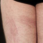 shiitake-1__protectwyjqcm90zwn0il0_focusfillwzi5ncwymjisinkildexmf0-6761875-8912940-jpg-4467201