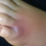 spider1__protectwyjqcm90zwn0il0_focusfillwzi5ncwymjisingildfd-2394784-6049630-jpg-5000659