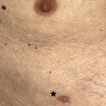 supernumnipple__protectwyjqcm90zwn0il0_focusfillwzi5ncwymjisinkildm2xq-2736639-7751844-jpg-7553342