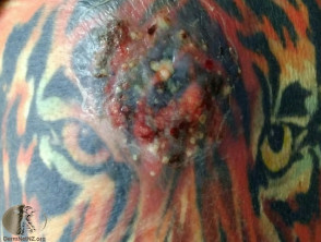 Carbuncle dentro del tatuaje de tigre