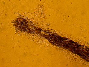 Invasión de Ectothrix por hifas de hongos en el tallo del cabello