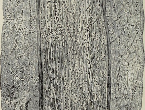 Invasión endothrix de un tallo de cabello por Trichophyton tonsurans 