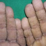 tripe-palms__protectwyjqcm90zwn0il0_focusfillwzi5ncwymjisingildfd-2994627-7568607-jpg-2507078
