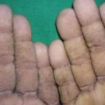 tripe-palms__protectwyjqcm90zwn0il0_focusfillwzi5ncwymjisingildfd-2994627-7568607-jpg-2507078