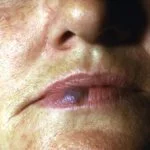 ven-lake__protectwyjqcm90zwn0il0_focusfillwzi5ncwymjisingildfd-9167612-8704414-jpg-5905646